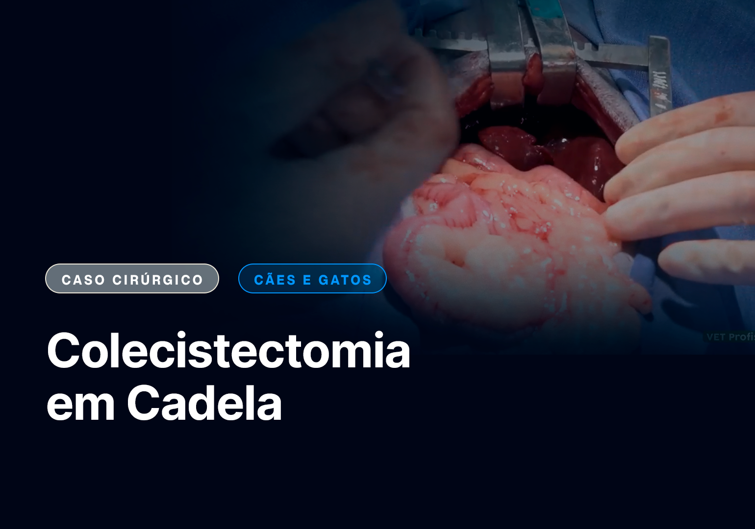 Colecistectomia