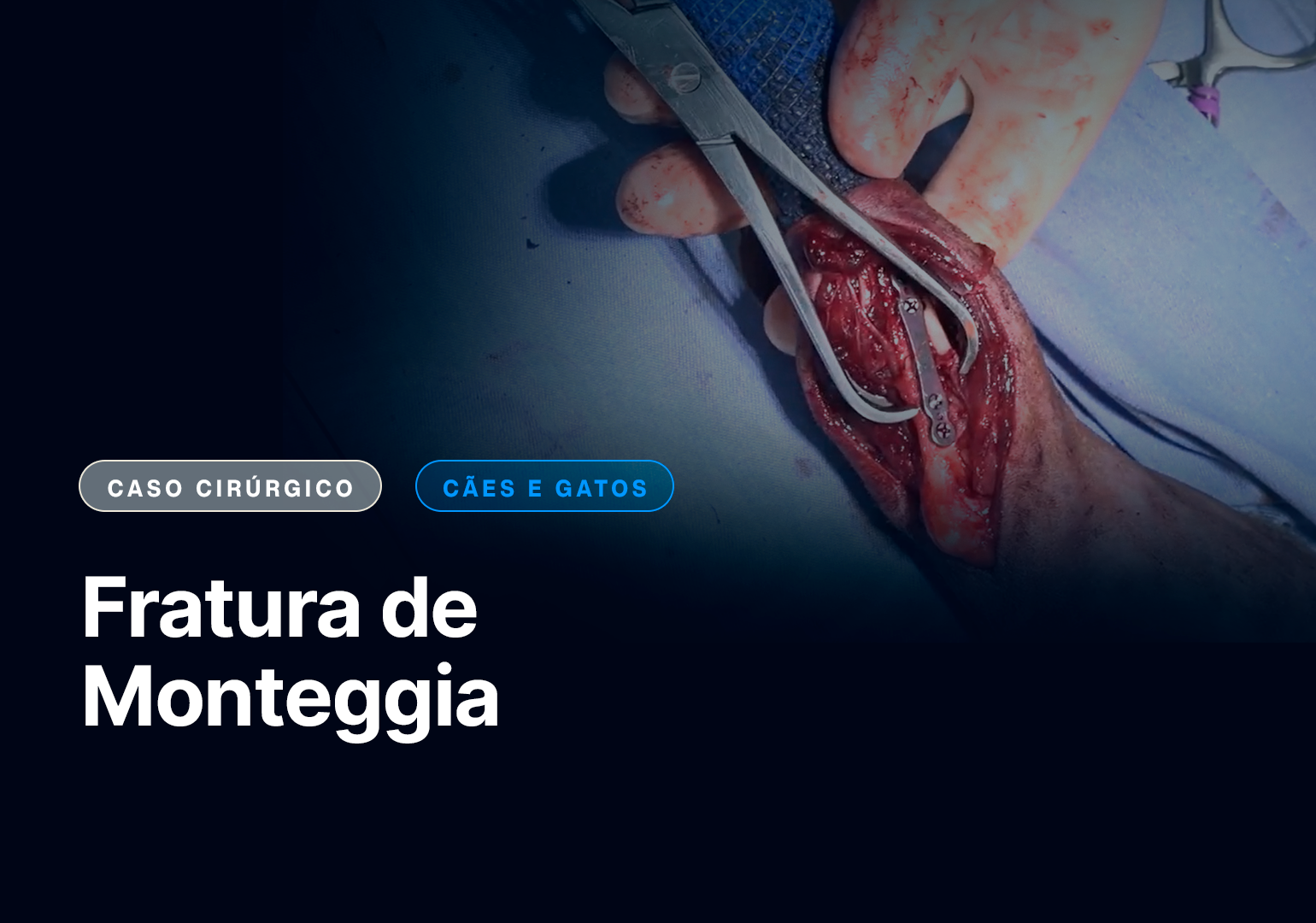 Fratura de Monteggia